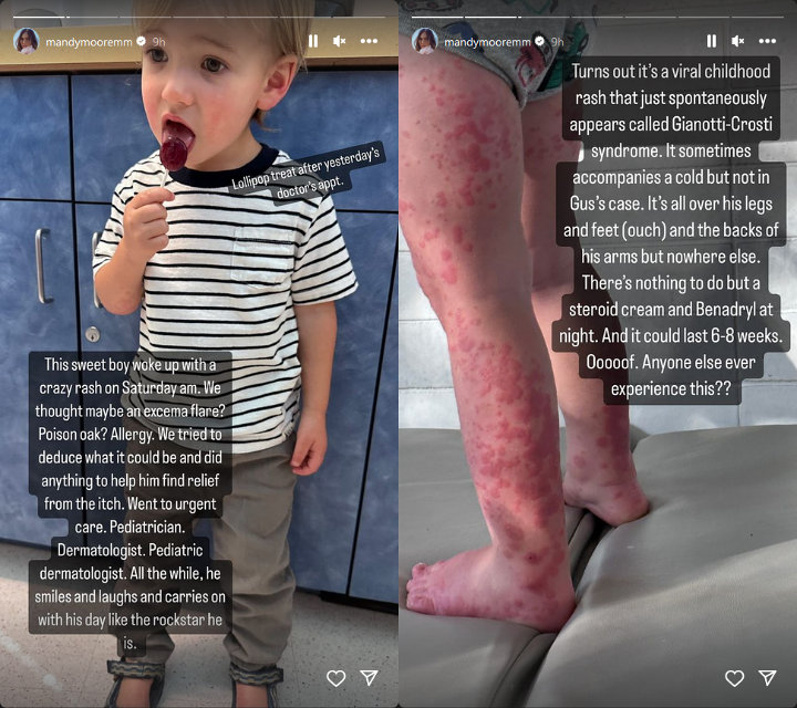 Mandy Moore's Instagram Story