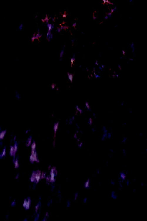 (Study II)