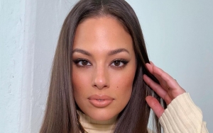Ashley Graham Shocks Fans With Back Bruises From Beauty Treatment