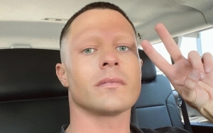 Colton Haynes Looks Completely Different Without Eyebrows in Jaw-Dropping Pics