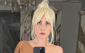 Lady GaGa Believed to Have Undergone Extreme Cosmetic Procedure as She Looks 'Noticeably Different'