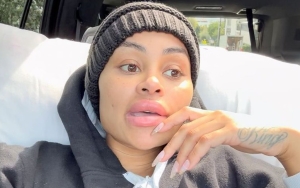 Blac Chyna 'Happy' After Removing All of Her Face Fillers