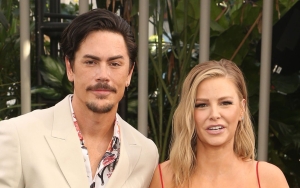 Picture of Tom Sandoval's 'Black Eye' Resurfaces After He Claims Ariana Madix 'Punched' Him