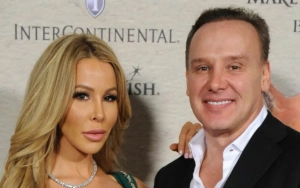 Lisa Hochstein's Ex Lenny Shuts Down Abuse Allegation After She Shared Photo of Injured Arm