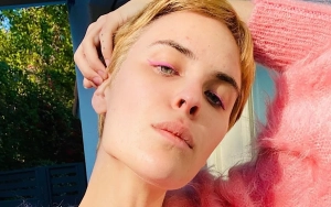 Tallulah Willis Shares Shocking Before-and-After Photos Amid Battle With Skin Picking Disorder