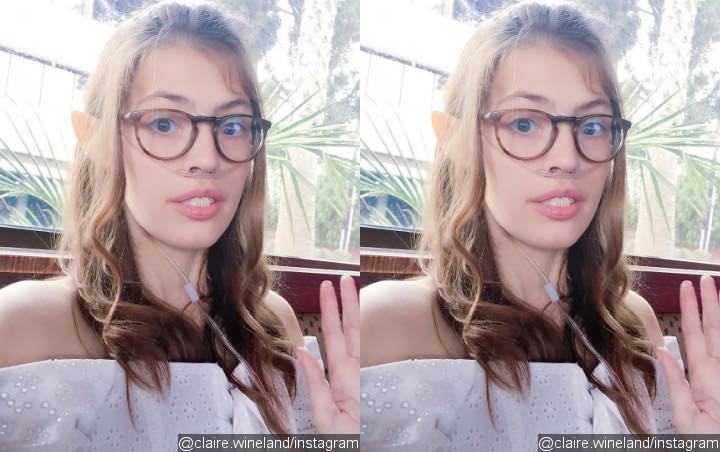 YouTube Star Claire Wineland Dies at 21 After Receiving Lung Transplant