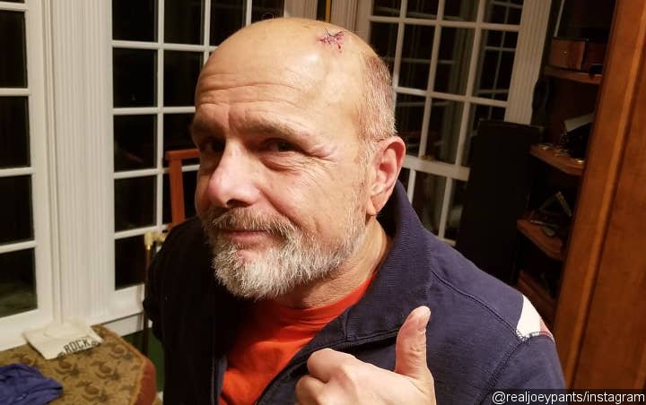 Joe Pantoliano Recovering in Hospital After Getting Hit by a Car