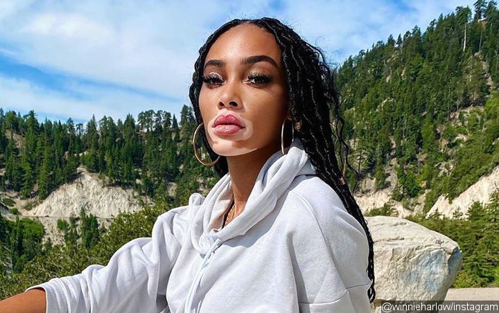 Winnie Harlow Uses Alcohol as Excuse After Being Dubbed a 'Mean Girl'