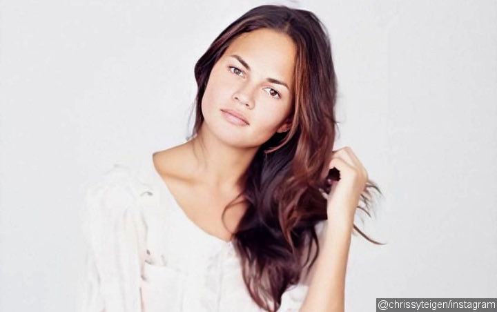 Chrissy Teigen Goes Topless to Offer a Look at Painful Sunburn