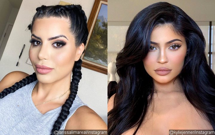 Larissa Dos Santos Lima Tries to Look Like Kylie Jenner With $72K Plastic Surgeries