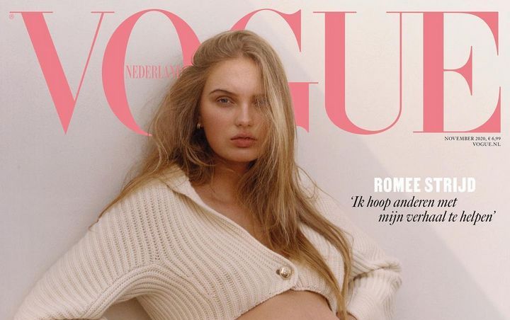 Model Romee Strijd Opens Up About Her Battle With Polycystic Ovary Syndrome