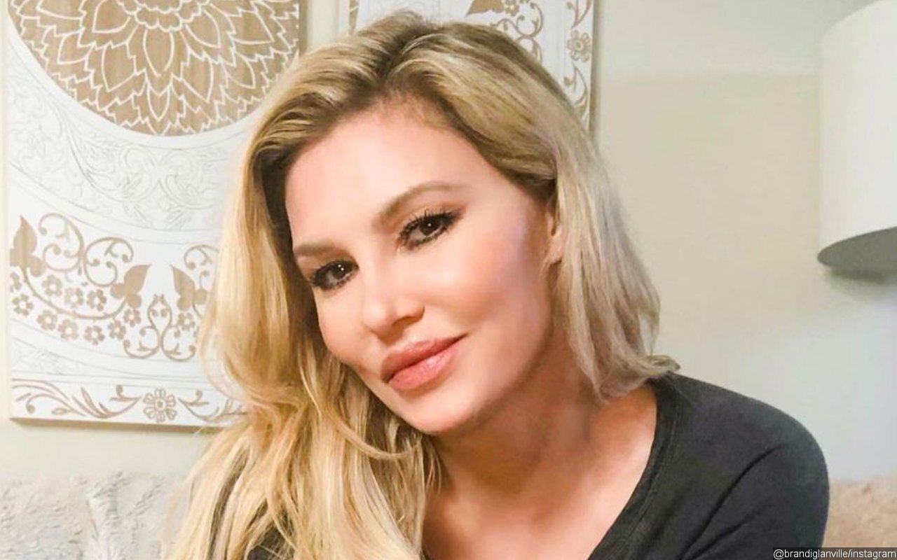 Brandi Glanville Shares Graphic Pic of Her Burned Face to Fight Back Tabloid for Attacking Her Look