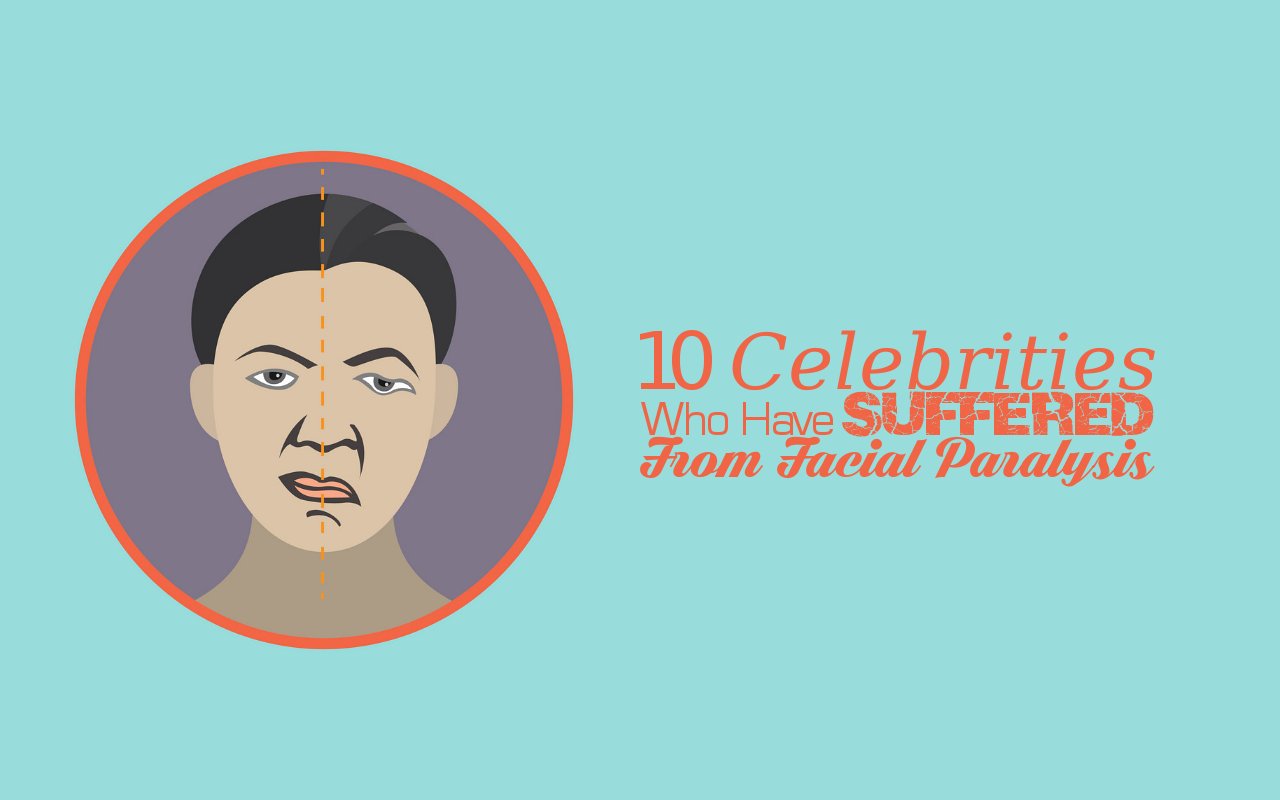 10 Celebrities Who Have Suffered From Facial Paralysis