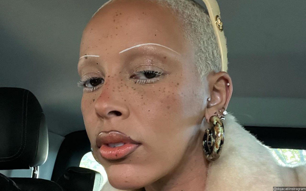 Doja Cat Embraces Her Freckles In New Selfies