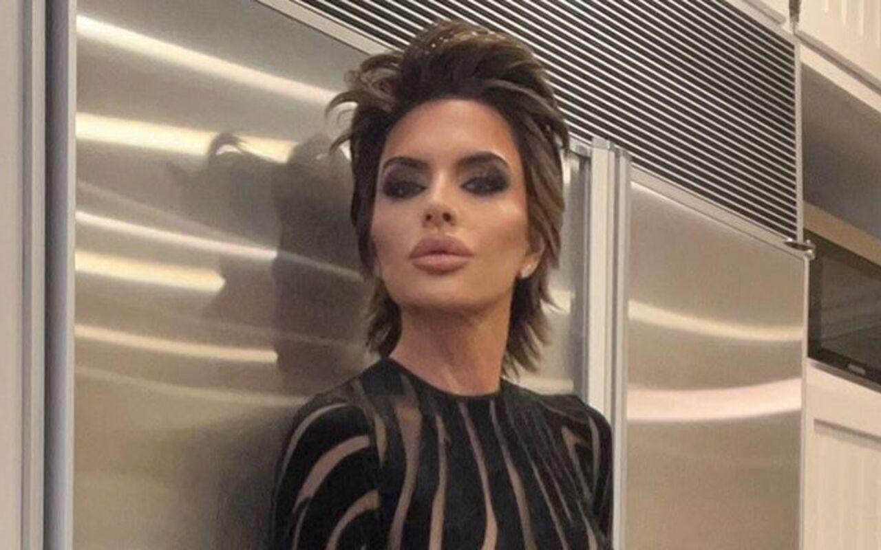 Lisa Rinna Compares Getting Lip Fillers to Getting Tattoo