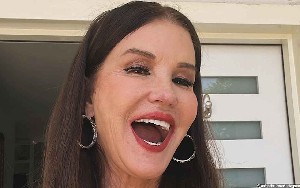 Janice Dickinson Reveals She Got First Plastic Surgery at This Age