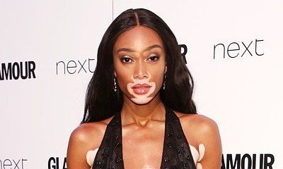 Winnie Harlow Proudly Flaunts Her 'Unique Beauty' as She Poses in Nothing But Nude Thong