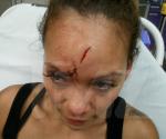 Evelyn Lozada's Bloody Head Photo From Domestic Violence Surfaces