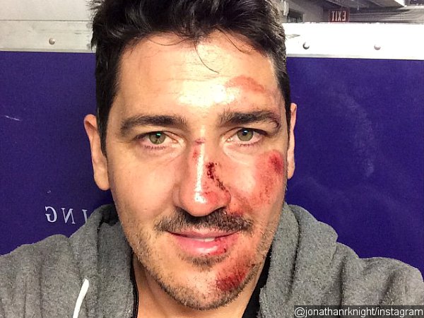 NKOTB's Jonathan Knight Misses Show After Breaking Nose in Tour Bus Accident
