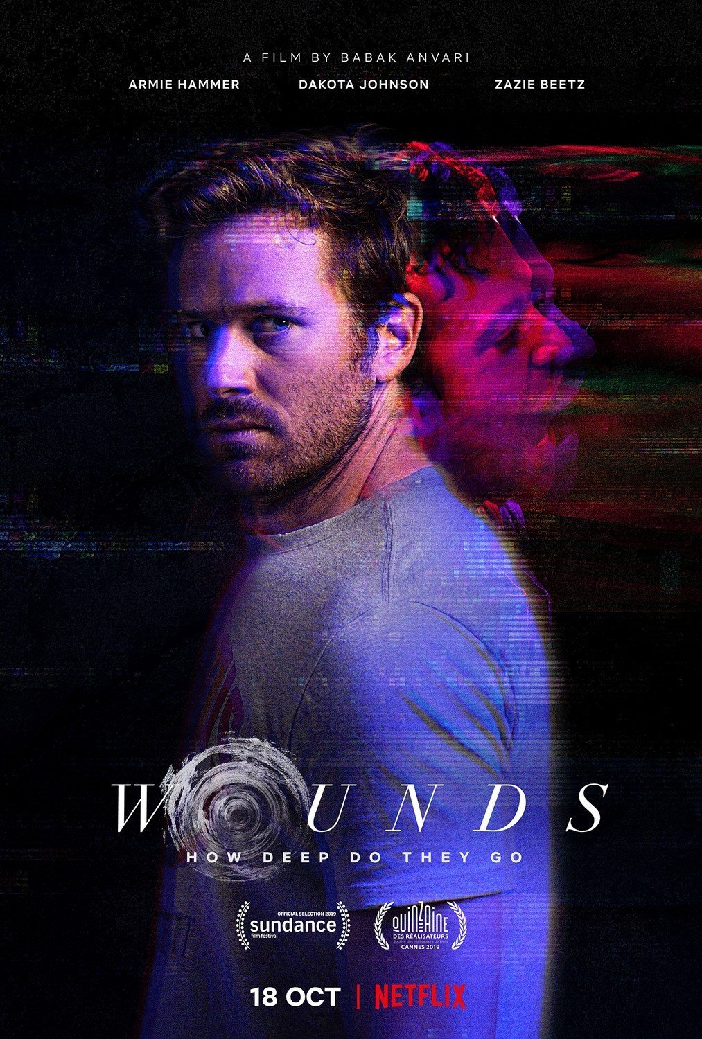 Poster of Hulu' Wounds (2019)